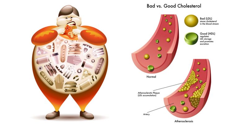 Cholesterol Ratio