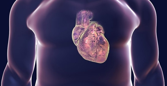 Valvular Heart Surgery