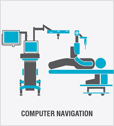 Computer Navigation