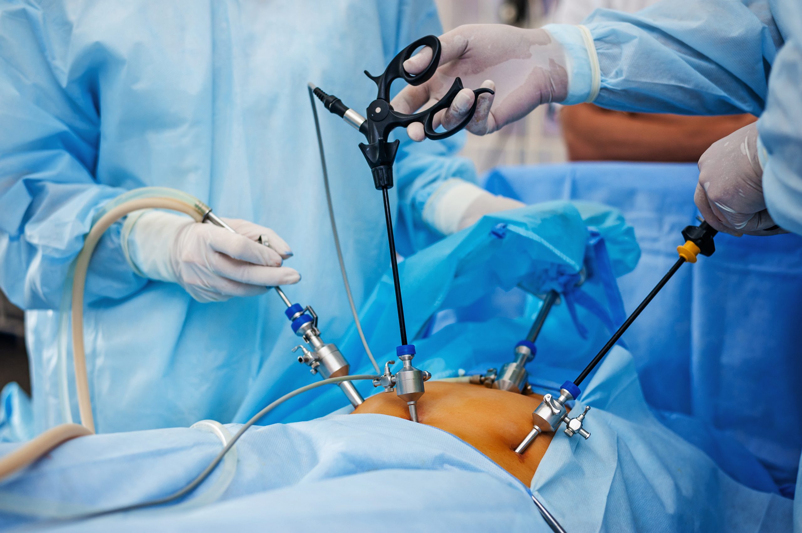 Advantages of Laparoscopic Surgery - Asian Health Blog