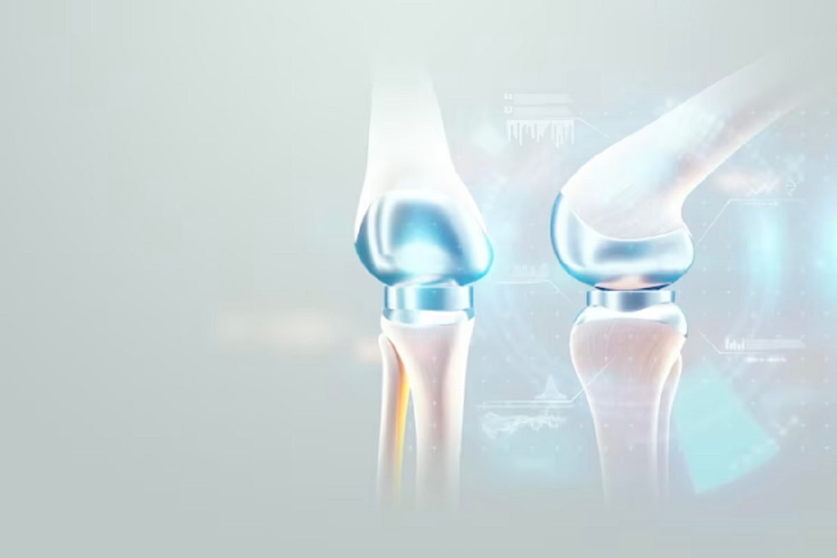 knee replacement surgery