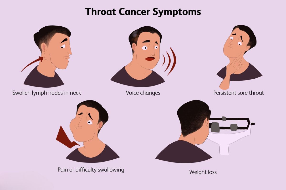 Throat Cancer : Symptoms, Prevention Tips, and Early Detection